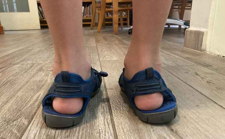 Child with flat feet wearing a pair of unsupportive sandals.