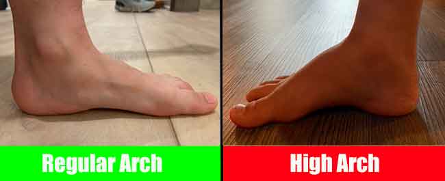 child-with-healthy-arches-vs-child-with-high-arches