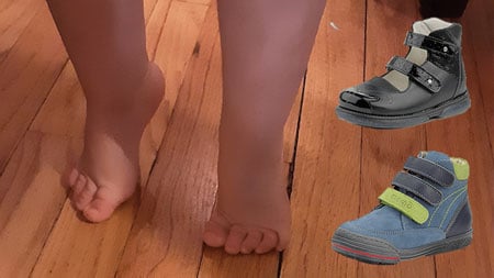 Orthopedic high-top shoes to help prevent children from walking on their toes.