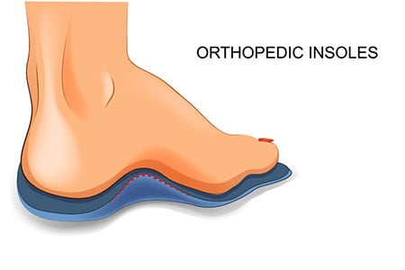 Orthopedic insoles for kids with high arches.