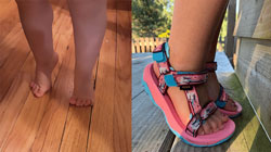 Sandals that are rigid at the front to help prevent children from walking on their toes.
