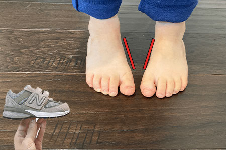 Corrective Shoes For Kids With Pigeon Toes To Improve Posture