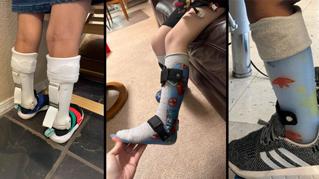 Examples of tall socks for AFOs.