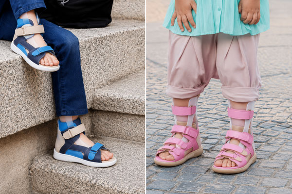 Children wearing AFOs with Memo sandals for added support and stability.